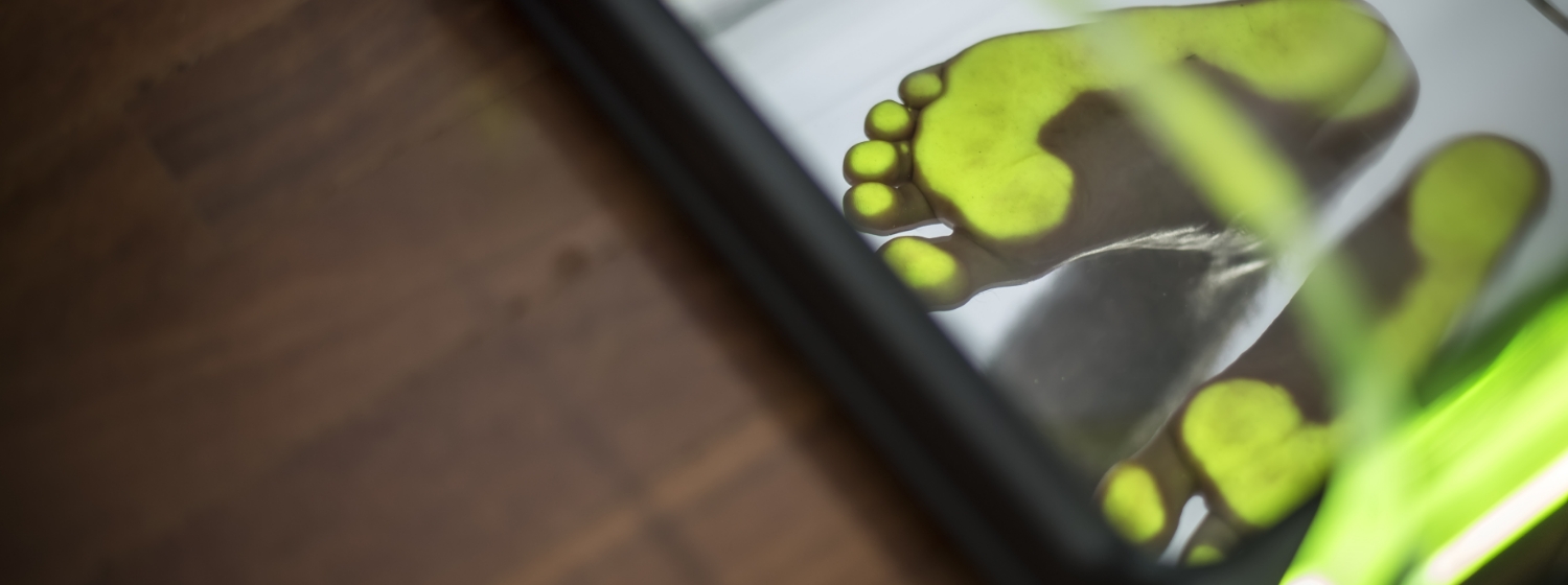 Estudio Biomecánico de la Pisada 2 - Podonutri